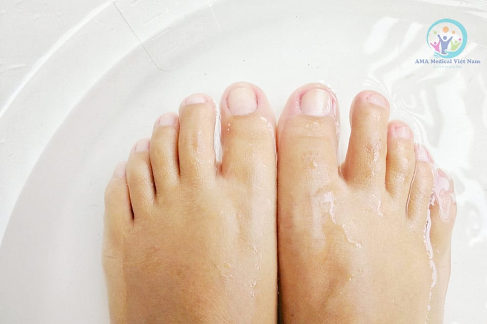 Ngâm chân trong nước muối có thể cải thiện tình trạng bệnh